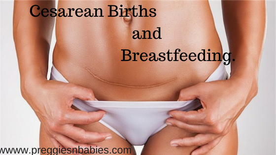 Cesarean Births and Breastfeeding.